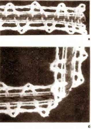 Коклюшки. Скань
